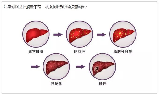 吃三七粉对脂肪肝有没有效果