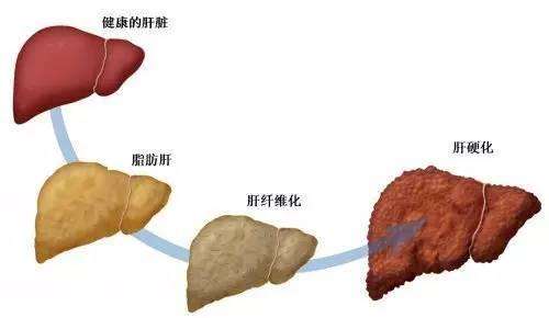 三七粉对肝脏的保护作用原理及吃法