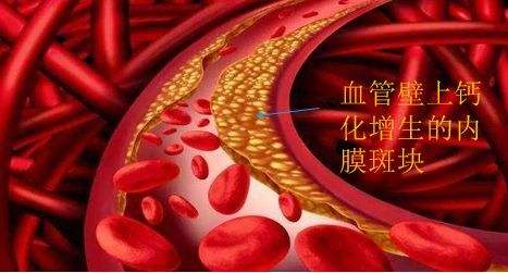 三七为什么被誉血管清道夫？详解三七粉对血管的作用